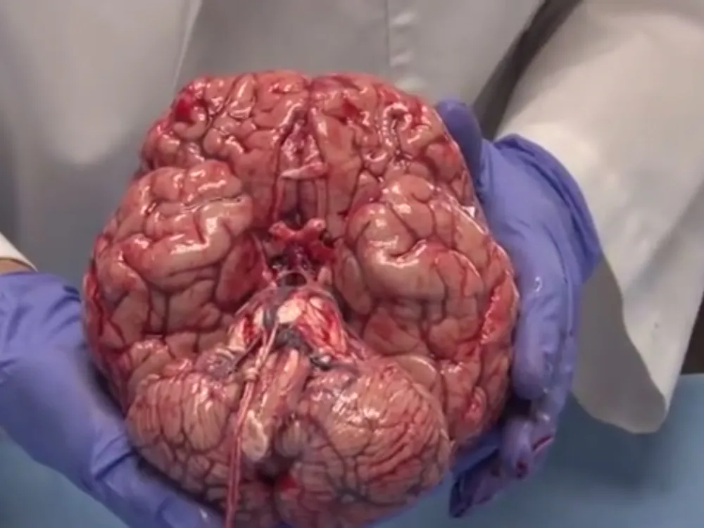 real human brain pictures