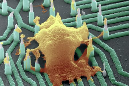 A colorized scanning electron microscope image of a neuron (orange) interfaced with the nanowire array.