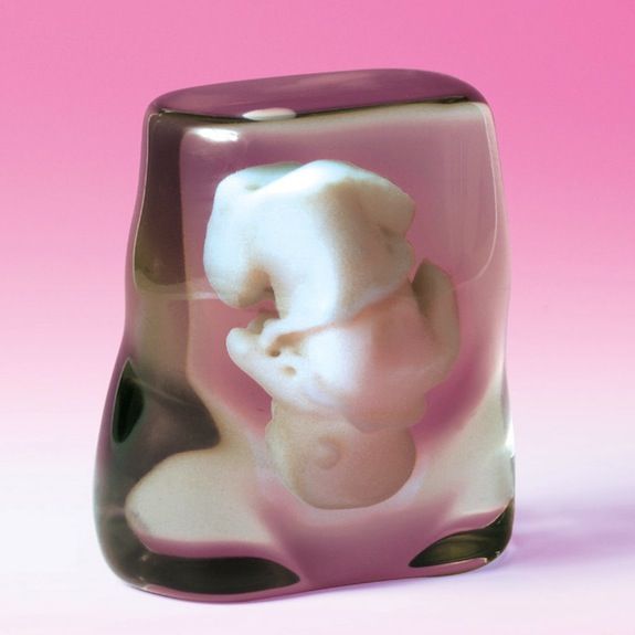 Clear rosin represents the mother’s tissue, while the fetus is suspended in white.