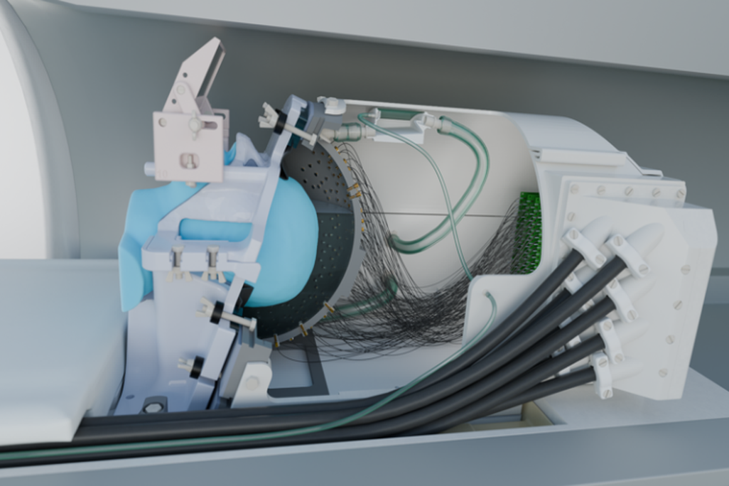 An illustration of the ultrasound helmet in an fMRI machine.