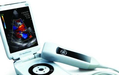 Reverse innovation in action: An ultrasound scanner shrinks to smartphone size.