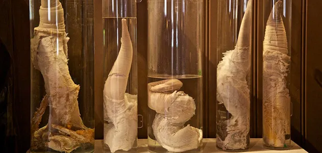 whale penises, penis museum