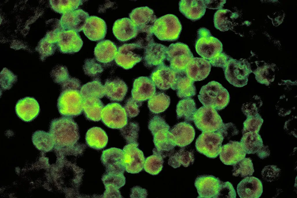 Naegleria fowleri