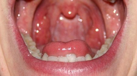 Everyone has a unique “fingerprint” of oral bacteria species, and new research shows that it correlates with genetic and ethnic factors.