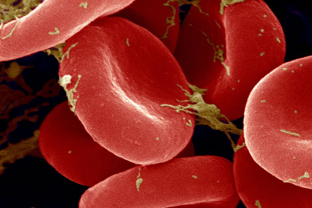 Red Blood Cells SEM