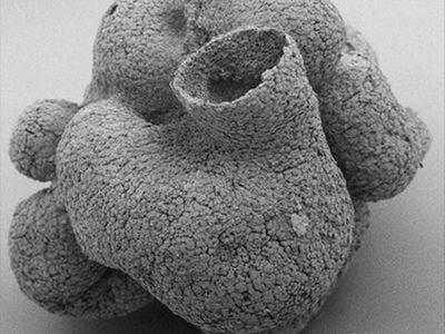 A scanning electronic microscope image of the 600 million-year-old sponge-like fossil