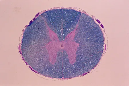 A cross-section of a spinal cord at five times magnification.