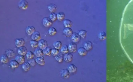 On the left are one type of Myxozoan-- spores of Kudoa iwatai--microorganisms recently reclassified as a member of the same group that includes jellyfish like the Aurelia aurita (moon jelly) on the right.