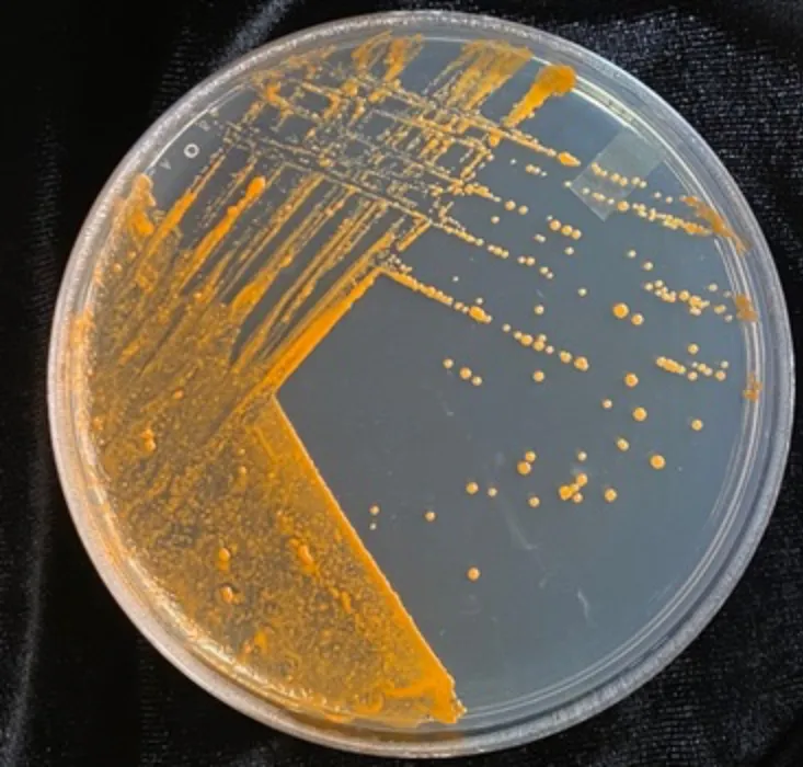 Orange bacteria in a petri dish