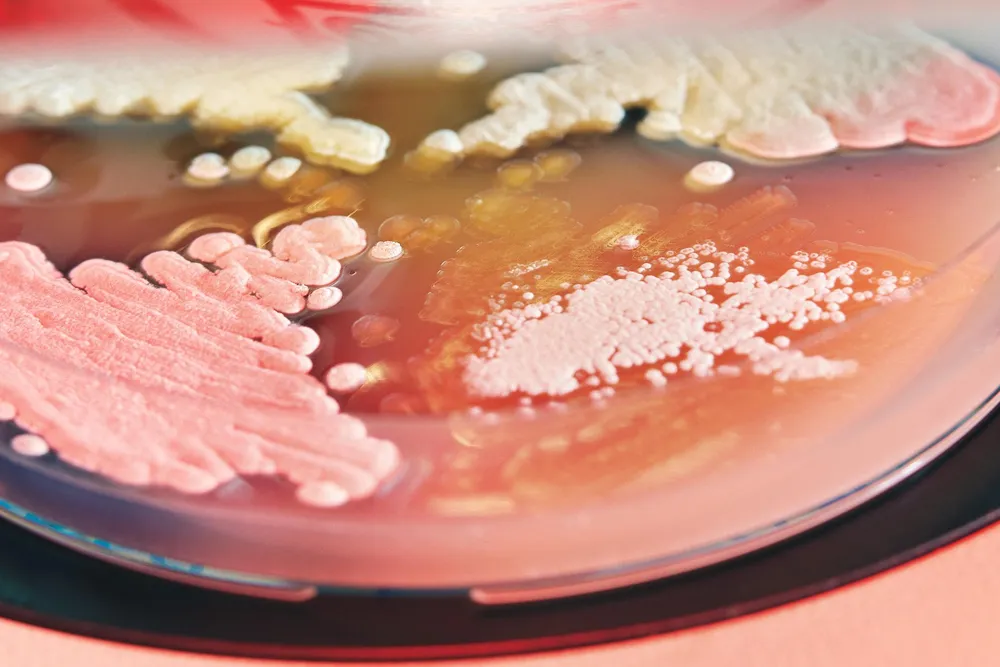 Streptomyces bacteria Opener 