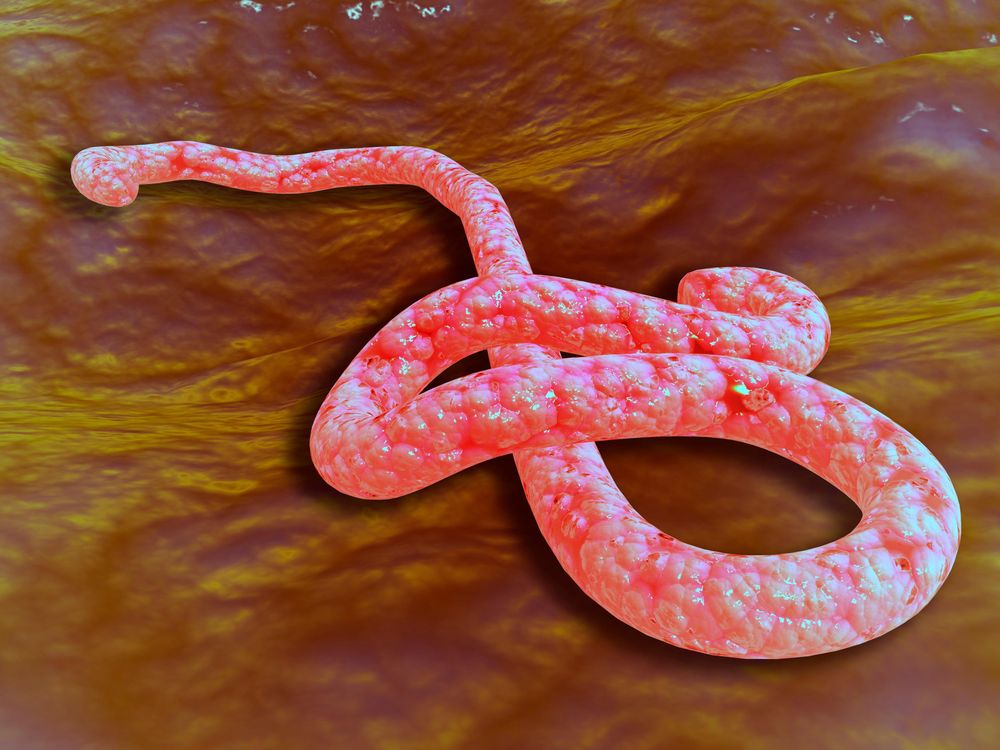 28_11_2014_ebola.jpg