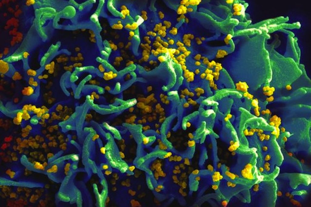 HIV-infected H9 T-cell Image