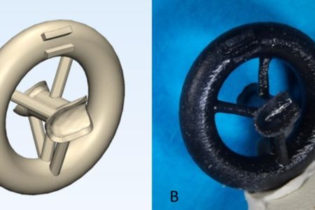Ear prosthesis