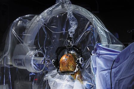 A neurosurgeon’s view during a brain operation: The head is held in place and covered with an adhesive drape containing iodine, which prevents infections and explains the orange tint. 
