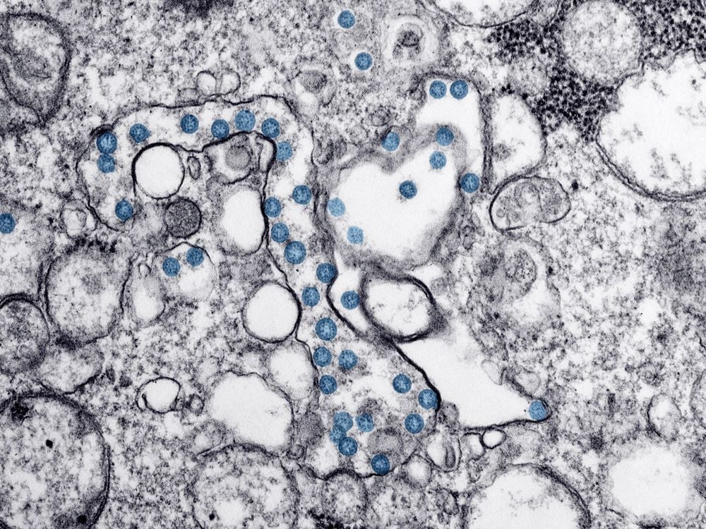 Microscope image of an isolate from the first U.S. case of Covid-19.