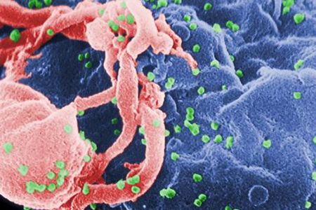 Scientists have identified a milk protein called Tenascin C that binds to HIV (the virus is shown here in green) and prevents it from injecting its DNA into human immune system cells (shown in purple, with pseudopodia in pink).