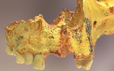 A partial Homo antecessor skull that was unearthed at the Gran Dolina cave site in the Atapuerca Mountains of  Spain.