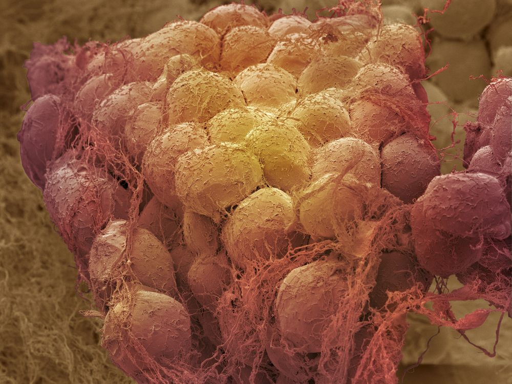 Yellowish orange blobs