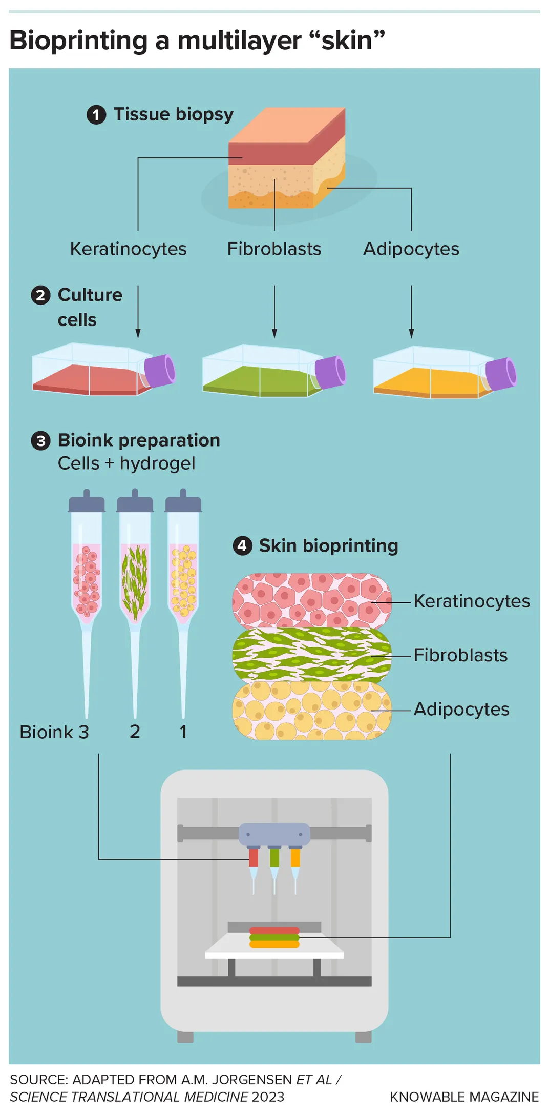 Can Printed 'Skin' Heal Burns and Prevent Scars?