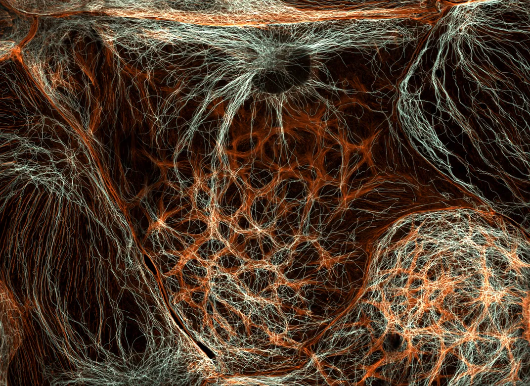 white and orange filaments