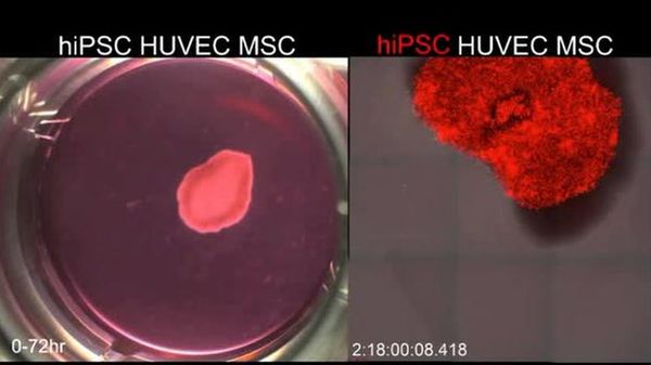 Preview thumbnail for Stem Cells Grow into a Liver Bud
