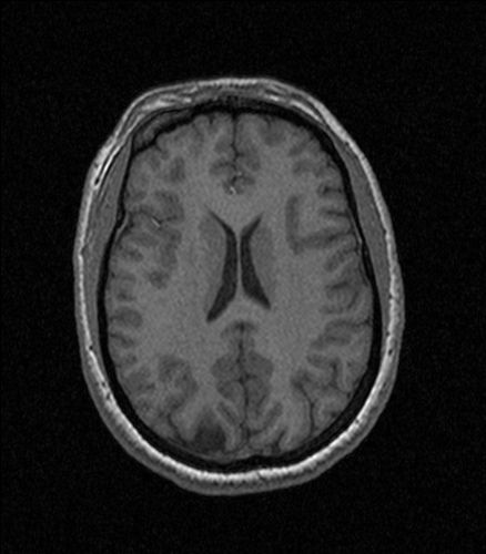 A functional magnetic resonance image of a brain.