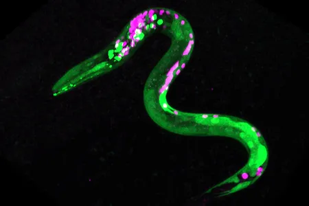 This worm is genetically engineered so some neurons and muscles are fluorescent. Green dots are neurons that respond to cannabinoids, while magenta dots are other neurons.