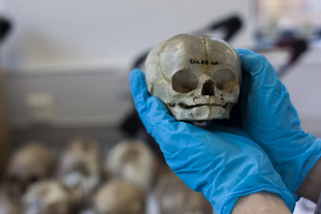 Infant Skull Whole