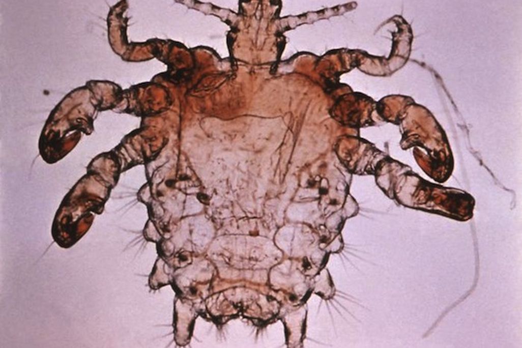 20130114092015Pthius_pubis_-_crab_louse.jpg