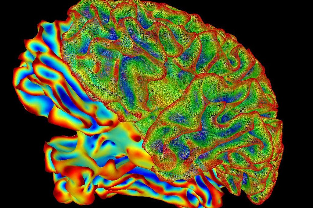 fMRI