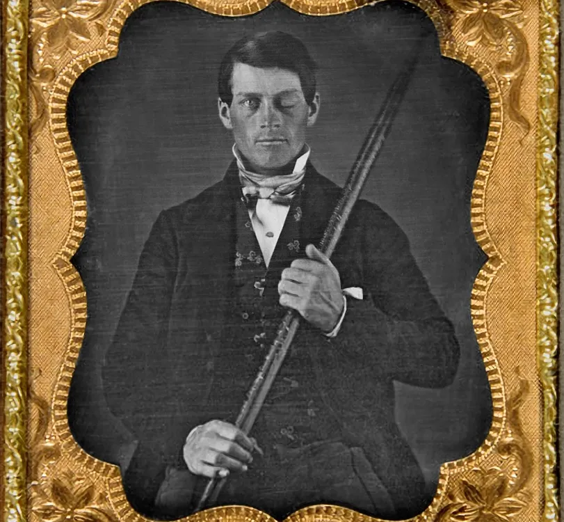 Phineas P. Gage
