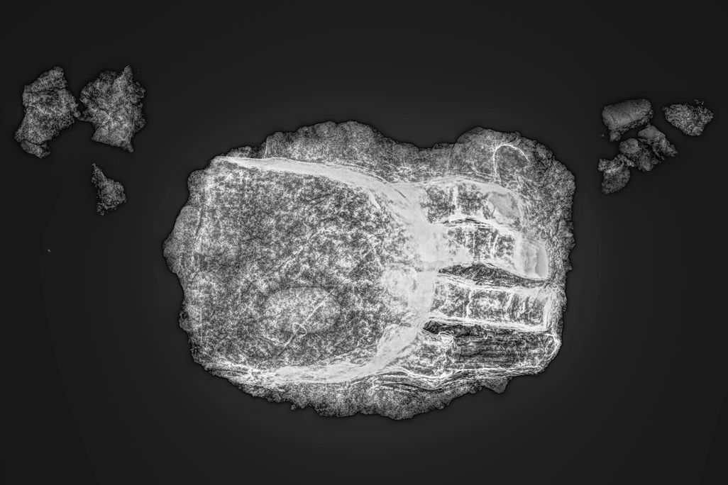 An x-ray of the hand