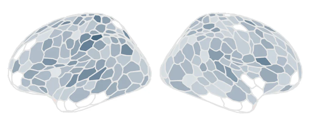 two diagrams of the brain in a grayscale heatmap, with darker and lighter areas spread throughout