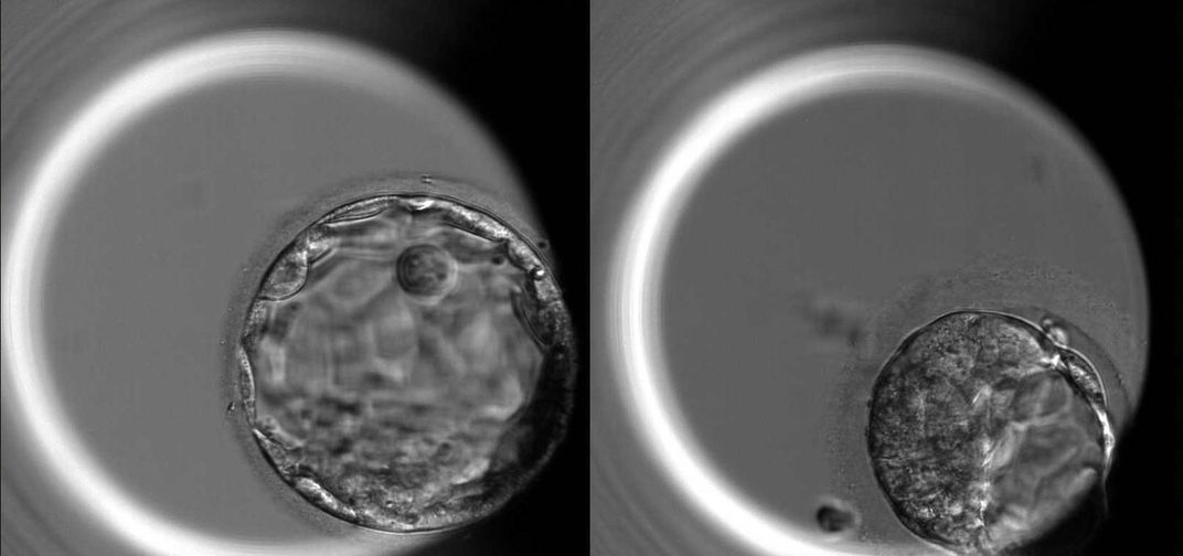 Gene Editing of Embryos Gives Insight Into Basic Human Biology