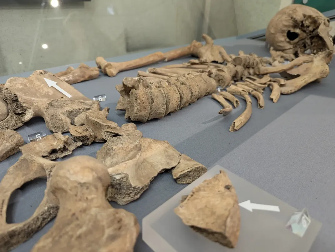 Skeleton laid on table
