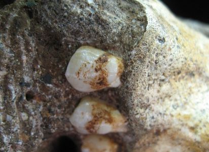 The dental plaque on Australopithecus sediba teeth reveals the species ate wood or bark.
