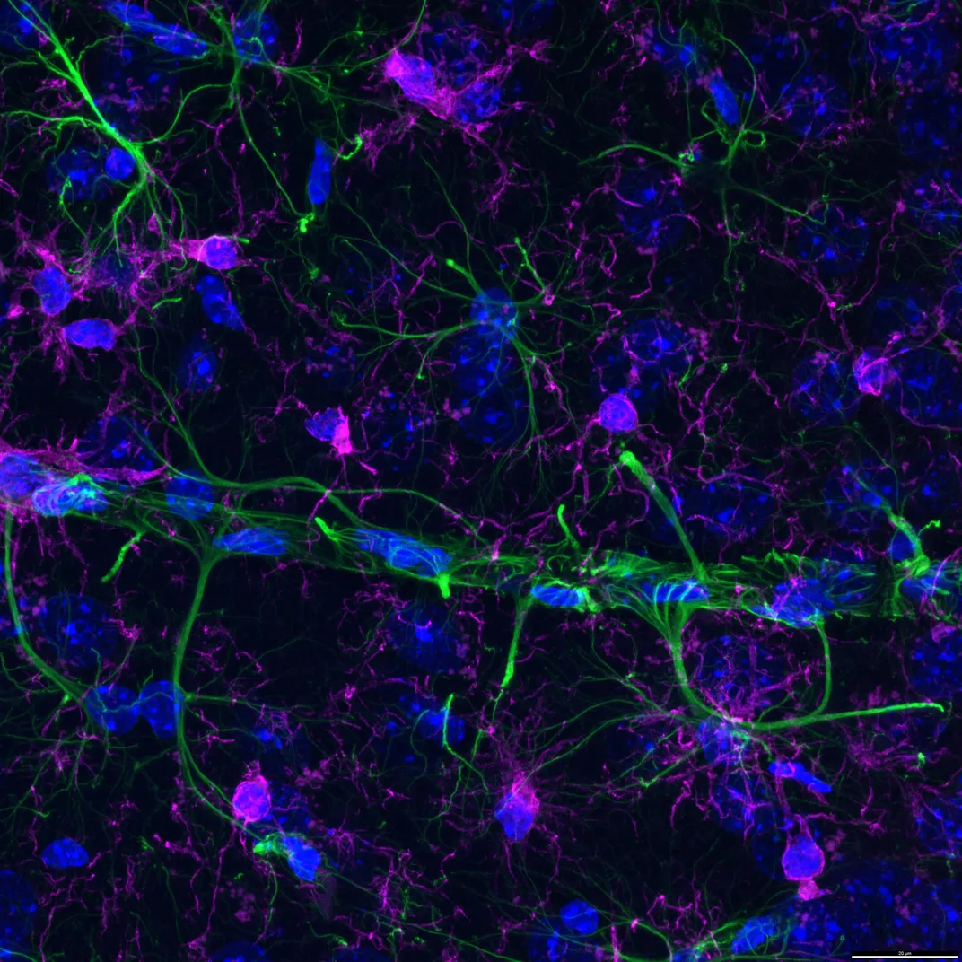 green branch with lots of purple cells around it
