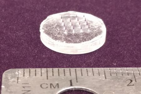 Microneedle patches, like this one that measures about a centimeter across, could be used to deliver nanoparticles when pressed to the skin for two minutes.