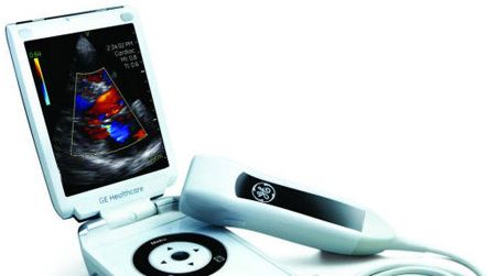 Reverse innovation in action: An ultrasound scanner shrinks to smartphone size.