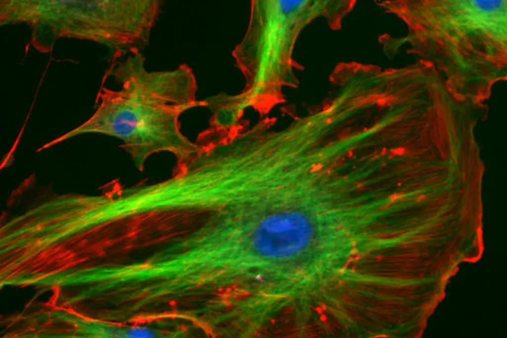 Endothelial cells under the microscope