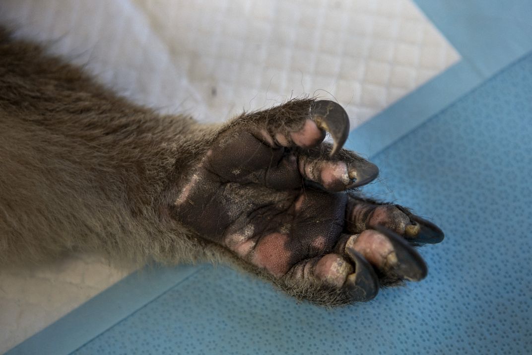 A hospitalized koala has pink spots on its paw that are healed burn areas.