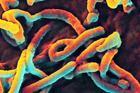 A digitally-colorized scanning electron micrograph (SEM) of Ebola virus particles.