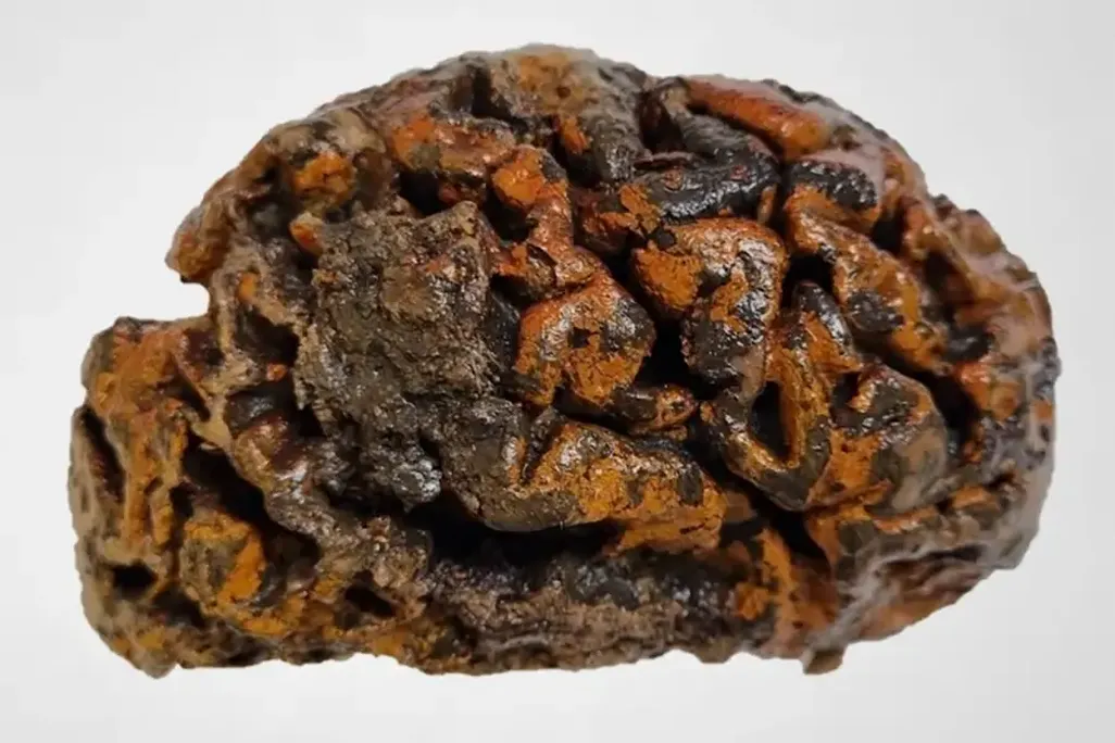 Preserved brain against a white backdrop