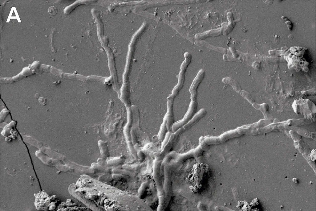 Two images of grey backgrounds with webs of small lines that look like vessels or roots of a plant; these are brain cells, which are thing elongated cells