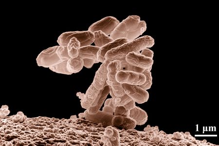 Low-temperature electron micrograph of a cluster of E. coli bacteria, magnified 10,000 times. Each individual bacterium is oblong shaped.