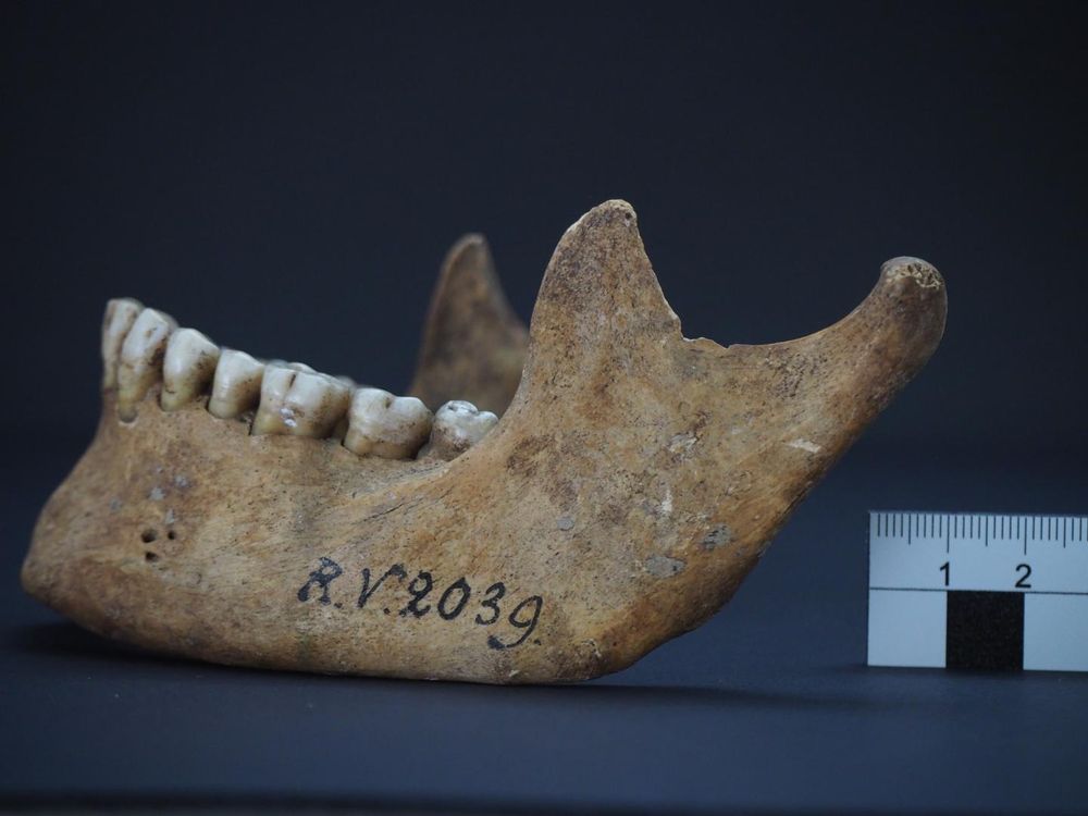 A photograph of human remains, a lower jawbone labeled RV 2039