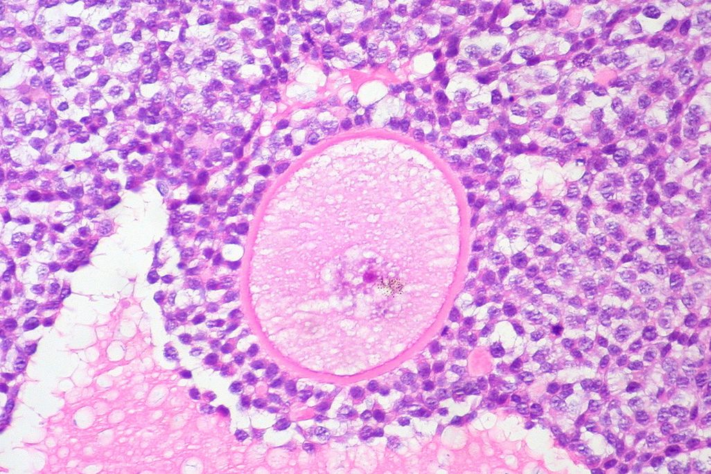 ovary.jpg