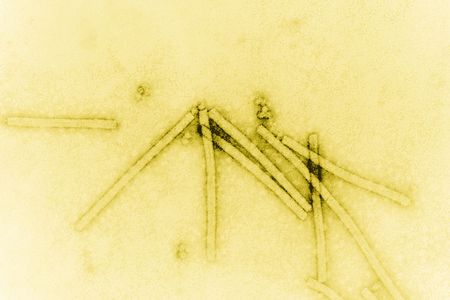 The tobacco mosaic virus seen under 160,000× magnification