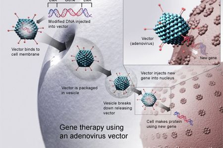 Gene therapy