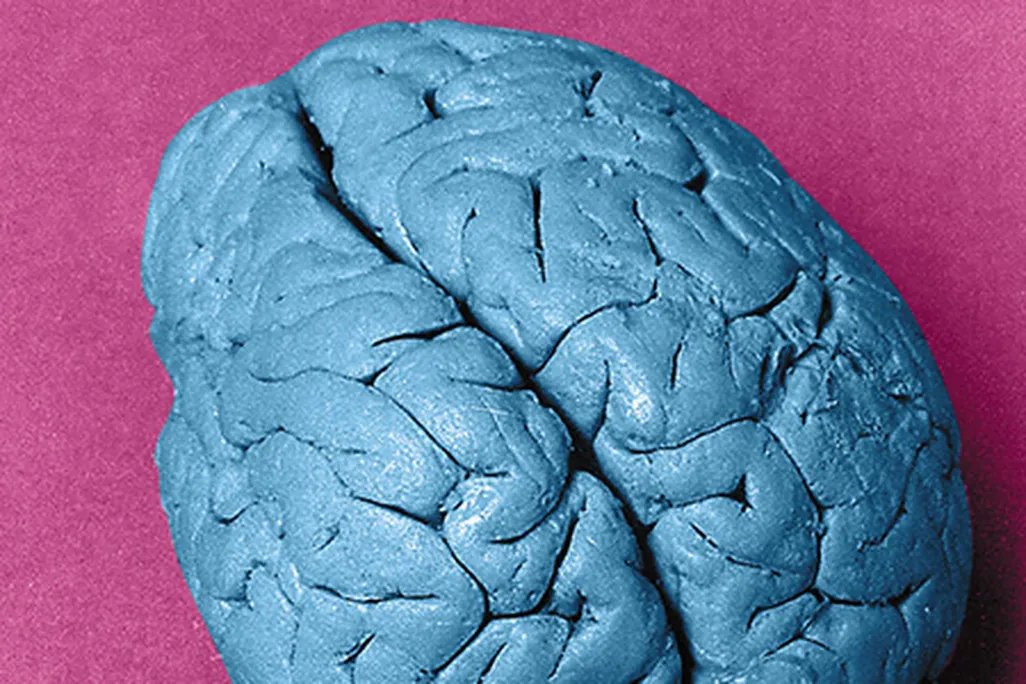 Leborgne’s brain